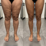 Magic Body – Masajeador 3 en 1